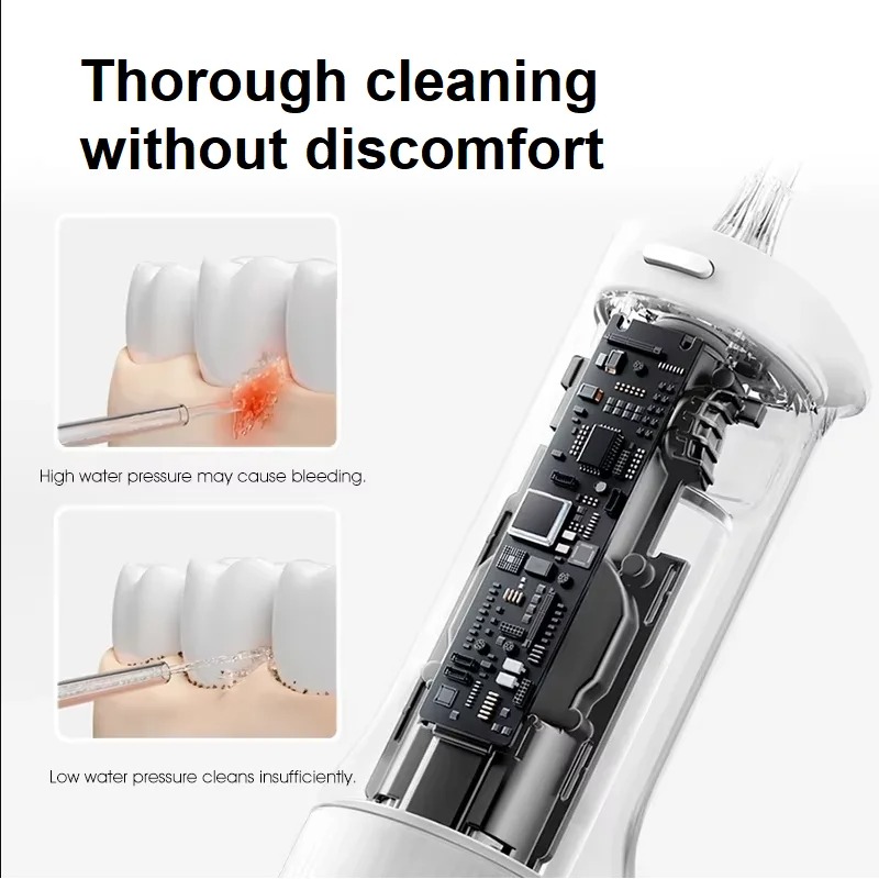 เครื่องฉีดน้ำทำความสะอาดช่องปา - Oral Irrigator Flosser บทวิจารณ์และราคา