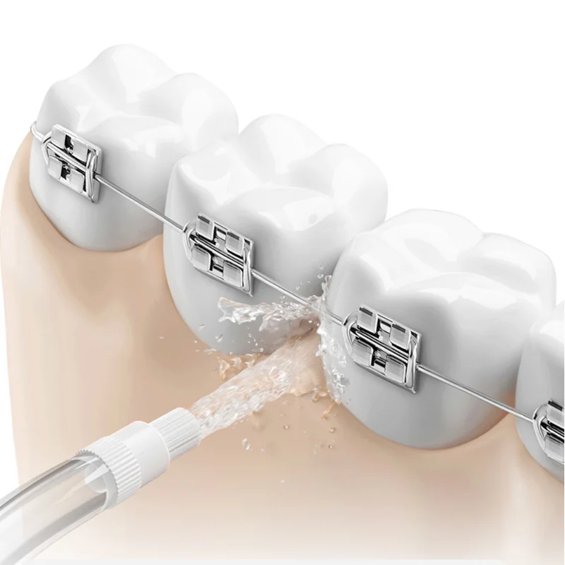 Original หัวฉีดสําหรับ Xiaomi  - Oral Irrigator Flosser บทวิจารณ์และราคา